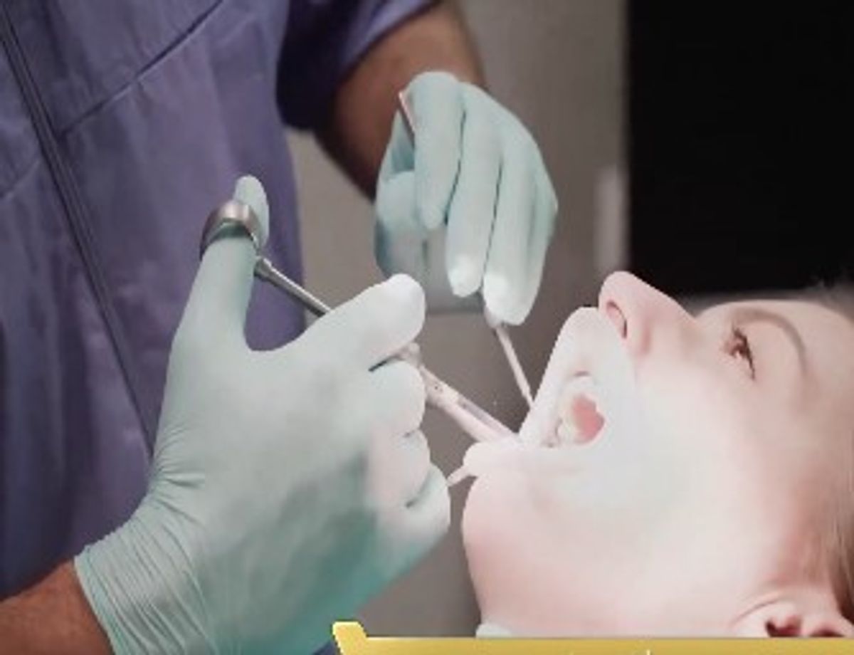 Experta advierte que la caries silenciosa avanza sin síntomas hasta el nervio dental