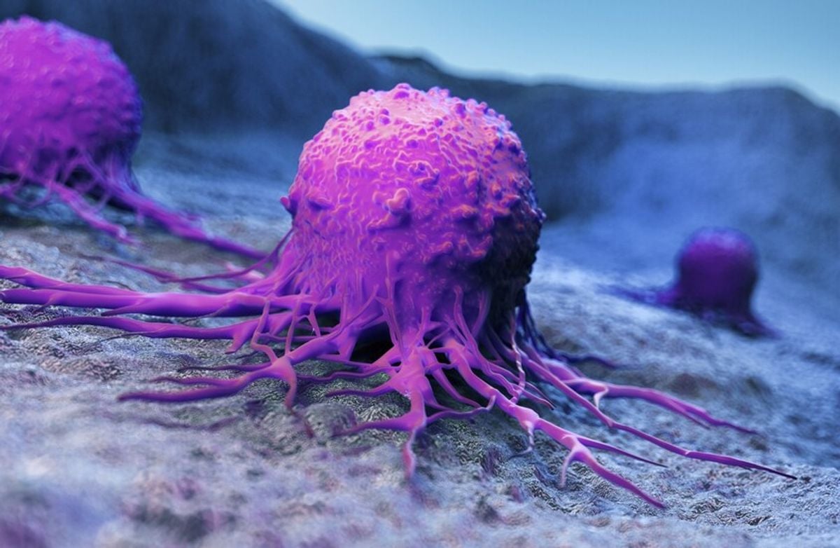 Experimental CAR-T cell therapy eliminates liver cancer signs in child