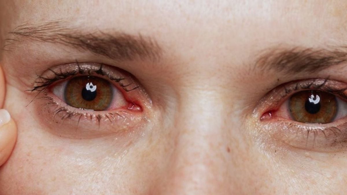 Saudi eye specialist discusses dry eye symptoms