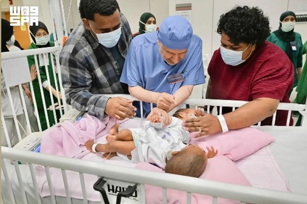 الربيعة يعلن بدء مرحلة الفصل الأساسية للتوأم السيامي الفيجي