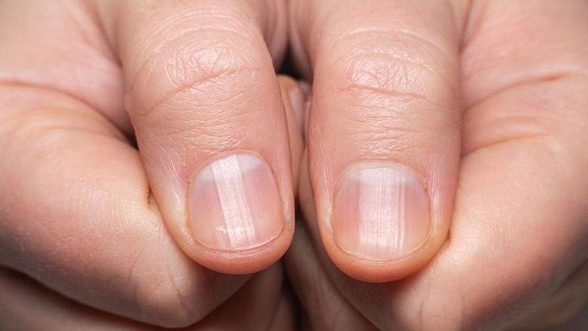 Nail changes may signal serious health issues, expert warns