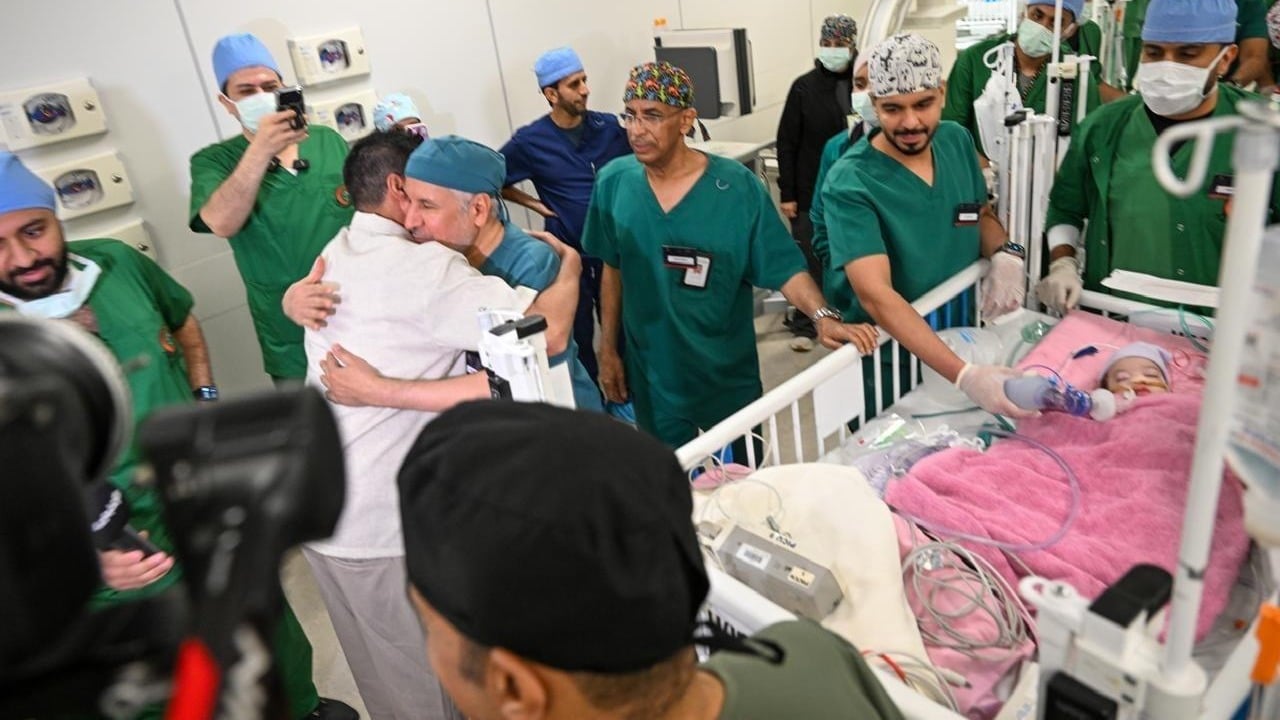 Succès de l’opération de séparation des jumelles siamoises marocaines à Riyad