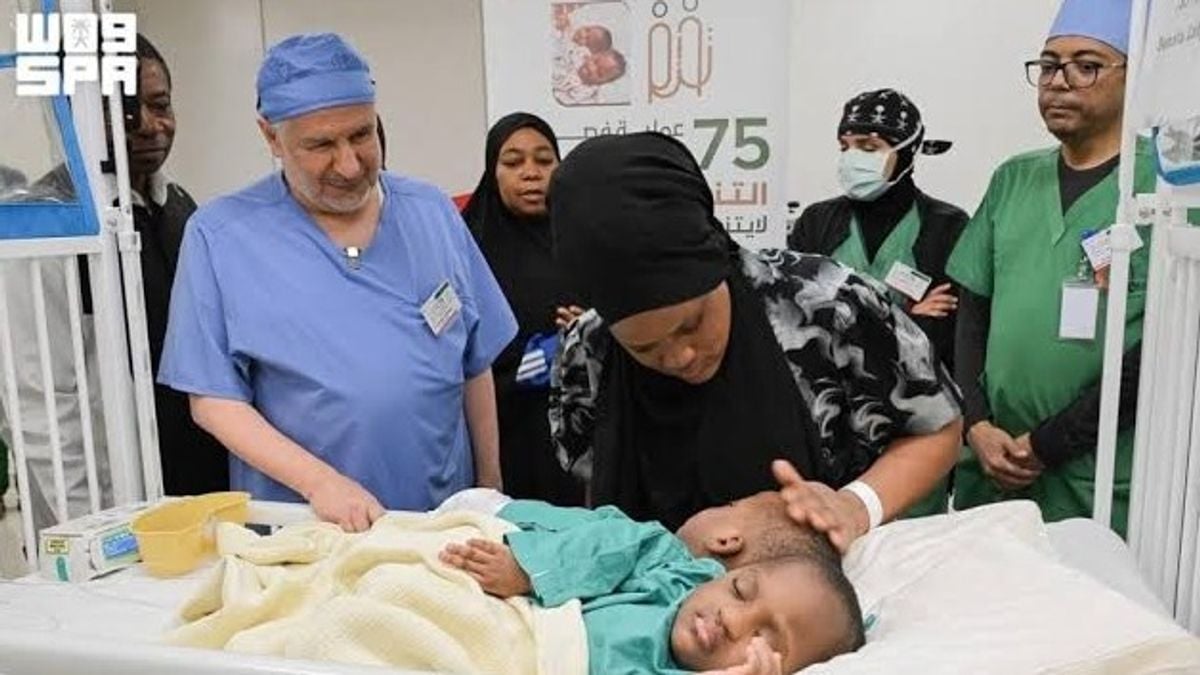 Separan con éxito a los siameses tanzanos Laetines y Lovens tras 15 horas de cirugía