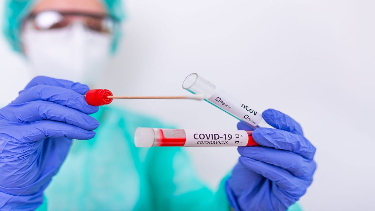 92.7 % نسبة التعافي من كورونا بالسعودية.. و3 ملايين إصابة بدول الخليج
