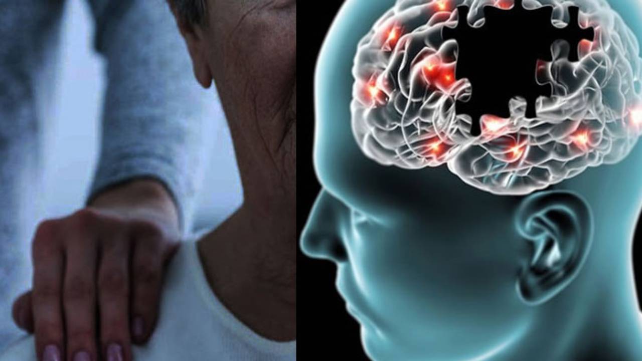 بالفيديو.. طبيب: النساء والمدخنون هم الأكثر عرضة للإصابة بـ«ألزهايمر»