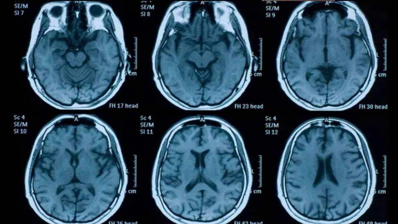 بالدليل.. هذا الطعام سبب للإصابة بالسرطان