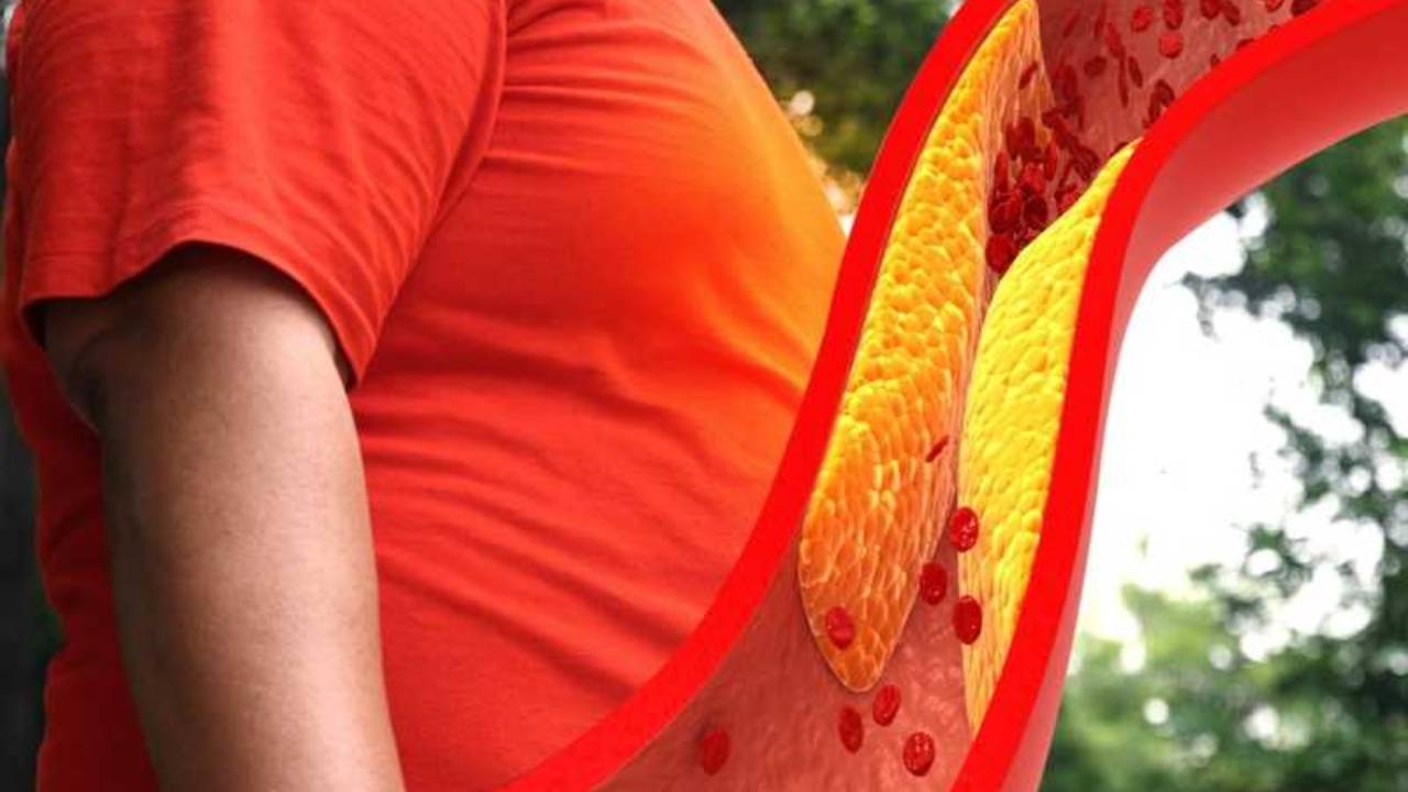 ماذا تعرف عن الدهون الثلاثية؟