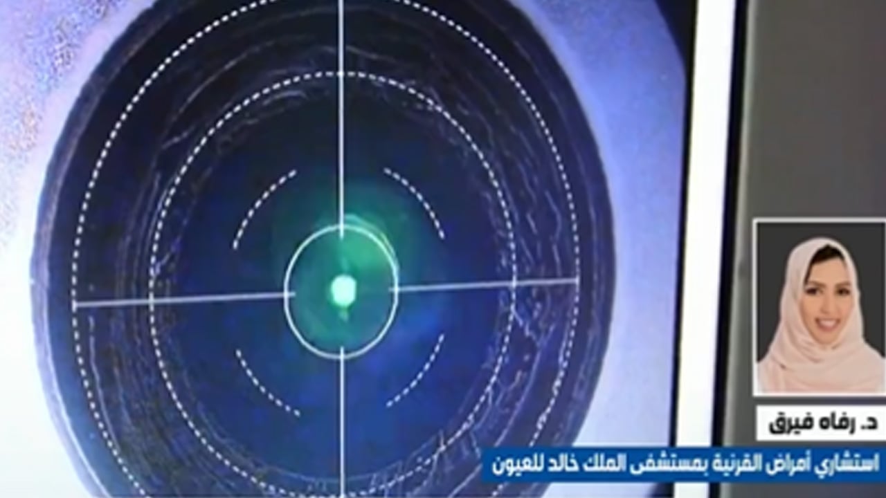 بالفيديو.. استشاري ينصح باستبدال العدسات اللاصقة فورًا في حالة واحدة
