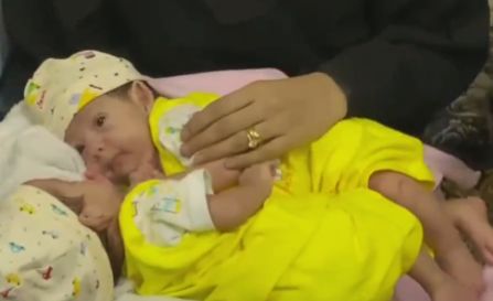 فريق «سلمان للإغاثة» يصل مطار عدن لنقل التوءم السيامي «مودة ورحمة» إلى الرياض
