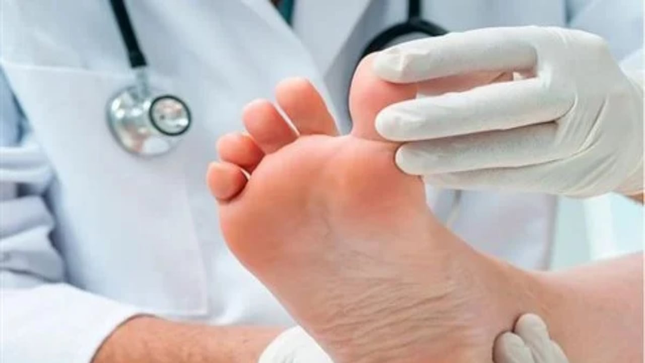  فهد الطبية:5 نصائح للوقاية من الإصابة بالقدم السكرية 