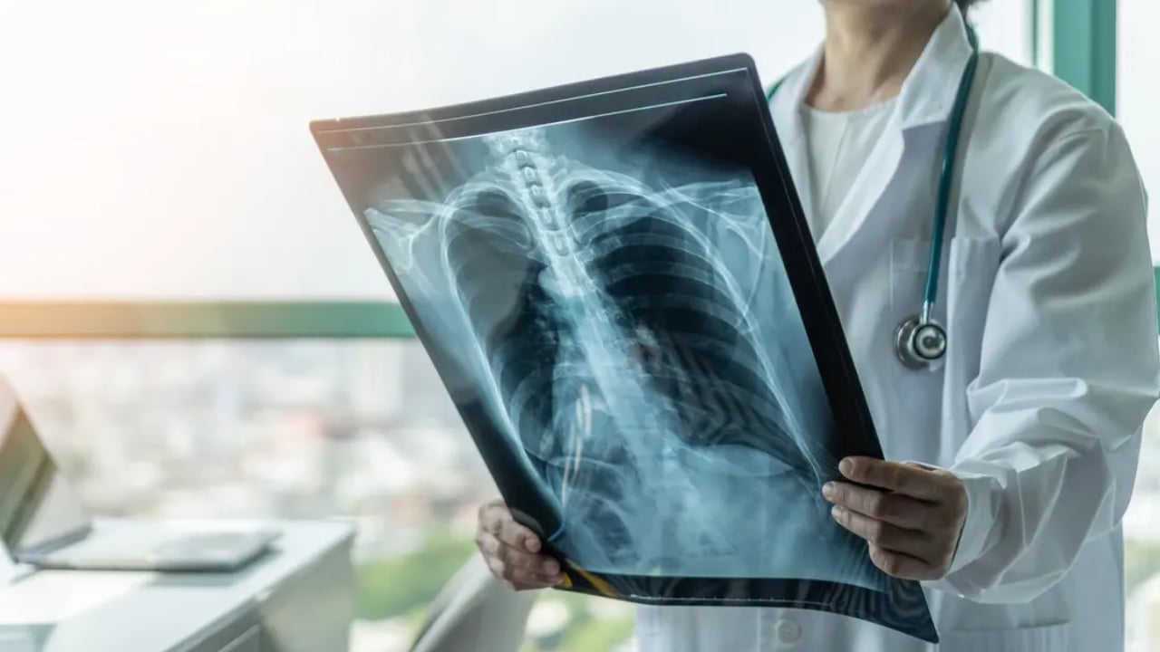 المشروب الأسوأ لسرطان البروستاتا