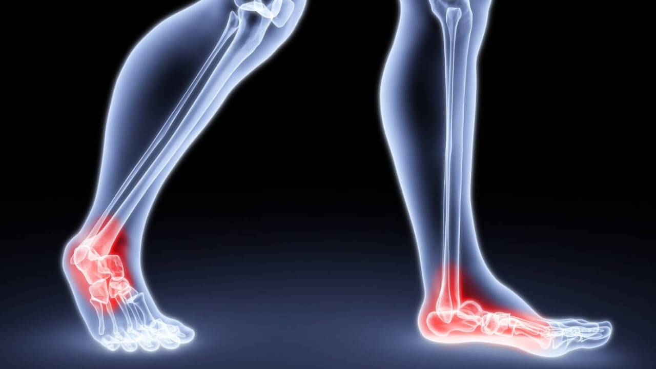 دراسة: الطول يزيد فرص تلف الأعصاب والتهابات الجلد والعظام