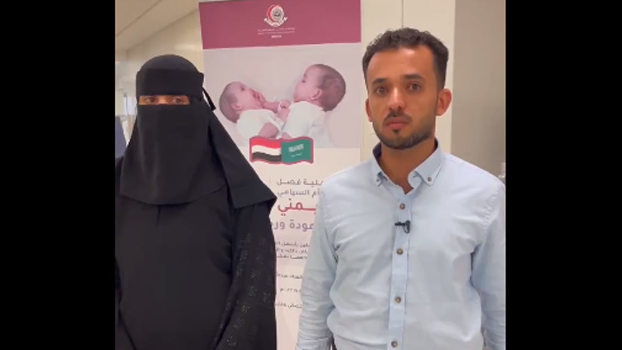 والدة التوأم اليمني تعبر عن سعادتها بنجاح عملية فصلهما
