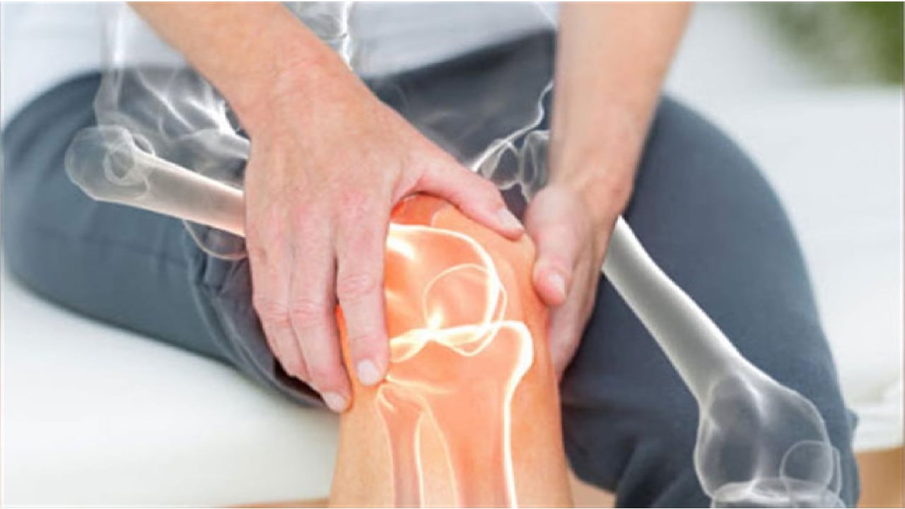 خبراء: الملح والسكريات والتدخين يؤدون إلى مخاطر على العظام  

