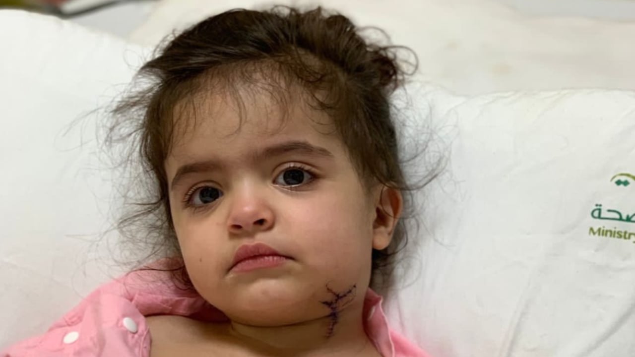 بالصور.. إنقاذ طفلة تعرض عنقها لقطع في تبوك