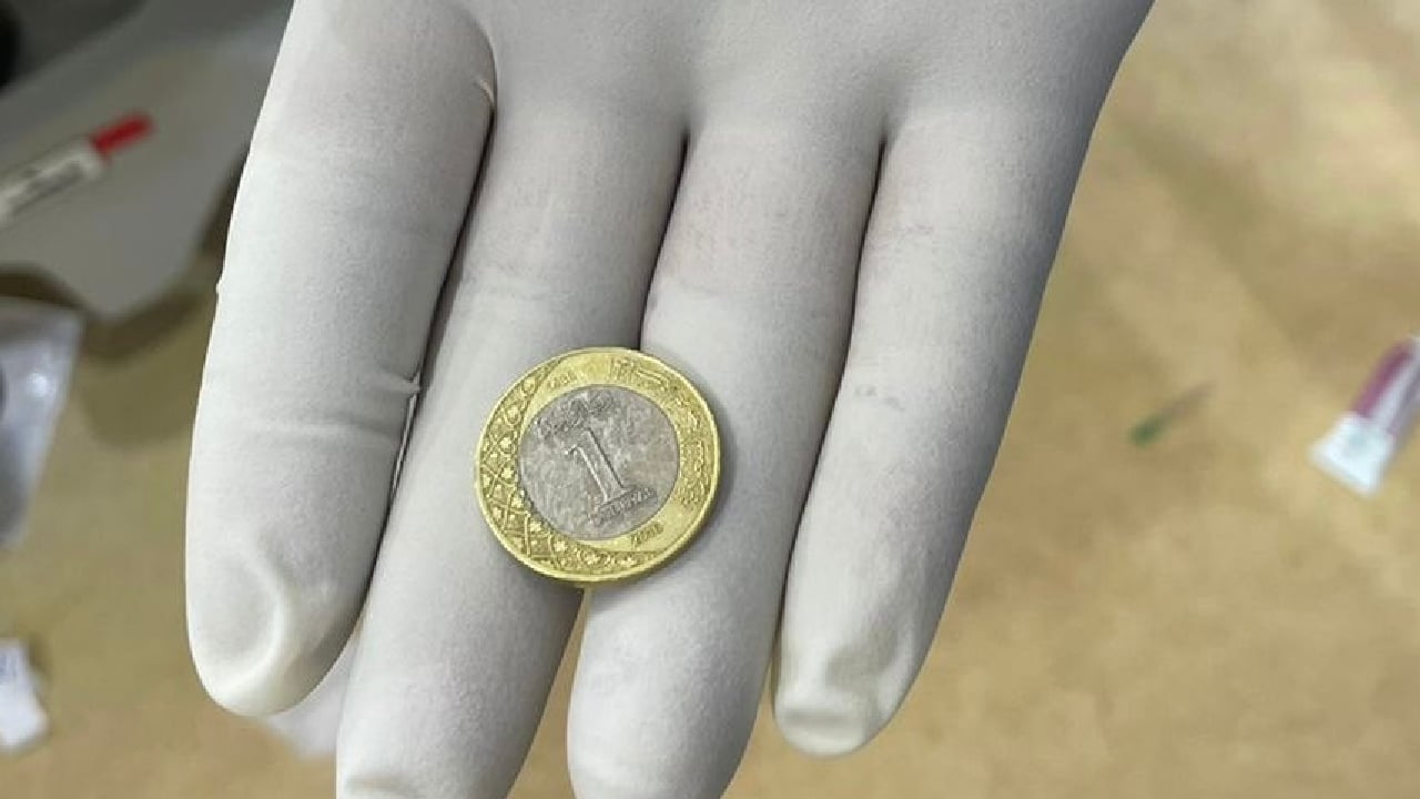 تسببت في انسداد مجرى الهواء.. إنقاذ طفل ابتلع قطعة معدنية في طبرجل

