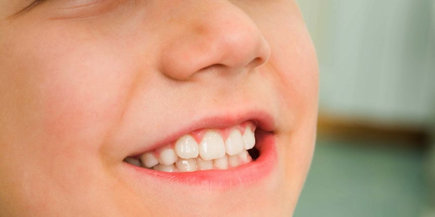 نصائح لحماية أسنان الأطفال من التسوس
