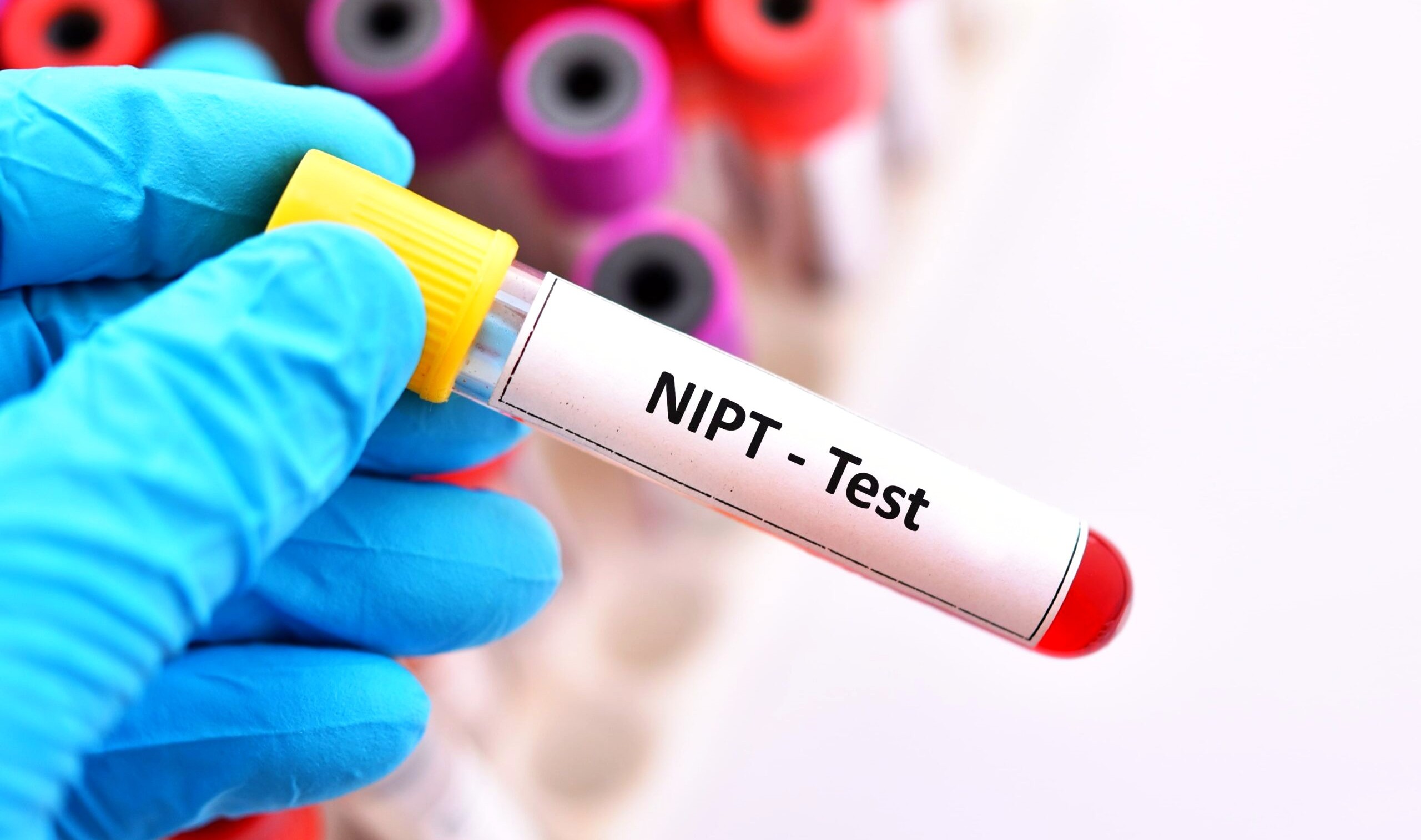 استشارية توضح فوائد عمل تحليل «NIPT» من دم الأم خلال الحمل