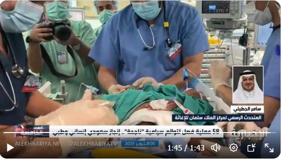 متحدث إغاثي الملك سلمان: المملكة تابعت 133 حالة من التوائم الملتصقة من 24 دولة  