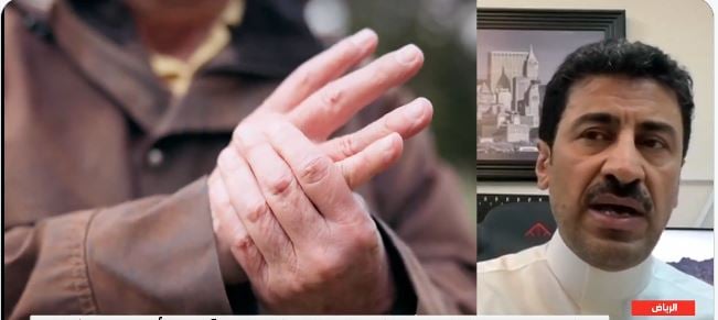 بالفيديو.. مختص: استخدامهم الجوال بكثرة وراء زيادة إصابة صغار السن بـ«الأبهر»
