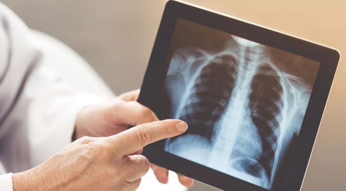 بالفيديو.. مختصة توضح أسباب أمراض التليف الرئوي وطرق الوقاية والعلاج