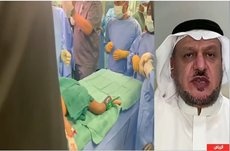 متحدث «سلمان للإغاثة»: أطلقنا برنامج رعاية للتوائم المتلاصقة لمساعدتهم خلال رحلتهم الحياتية