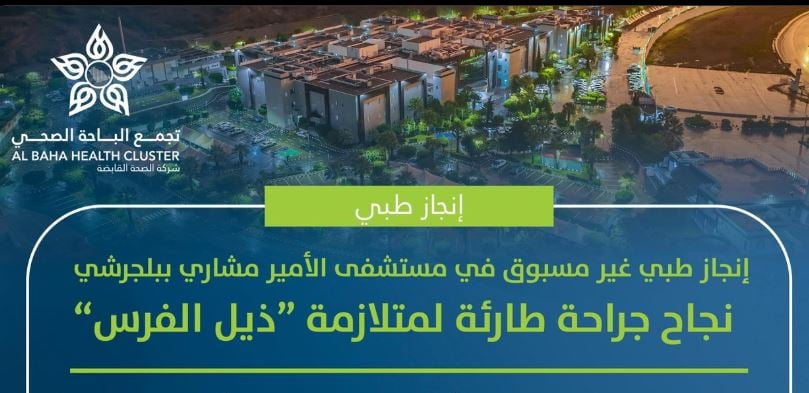 إنجاز طبي غير مسبوق بمستشفى الأمير مشاري.. نجاح جراحة طارئة لمتلازمة «ذيل الفرس»  