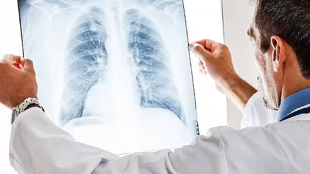 التدخين والسمنة.. تجمع القصيم الصحي يوضح العوامل التي تزيد من خطر الإصابة بالسرطان