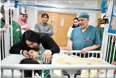اكتمال فصل التوأم الفلبيني الملتصق ضمن المرحلة الرابعة من العملية