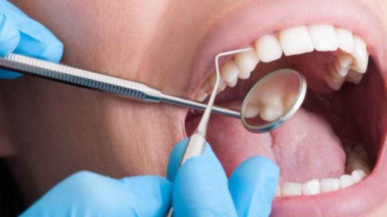 خمسة تغيرات بالفم توحي بأمراض خطيرة.. انتبه لها