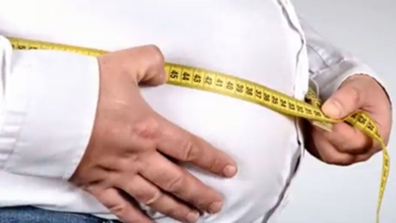 استشاري: السمنة أساس لـ7 أمراض.. وعمليات التجميل ليست ضرورة