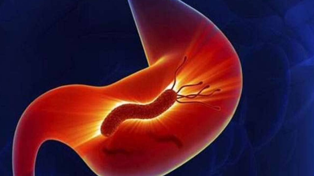 بالفيديو.. طبيب يوضّح طرق الإصابة بجرثومة المعدة وأضرارها على المعدة