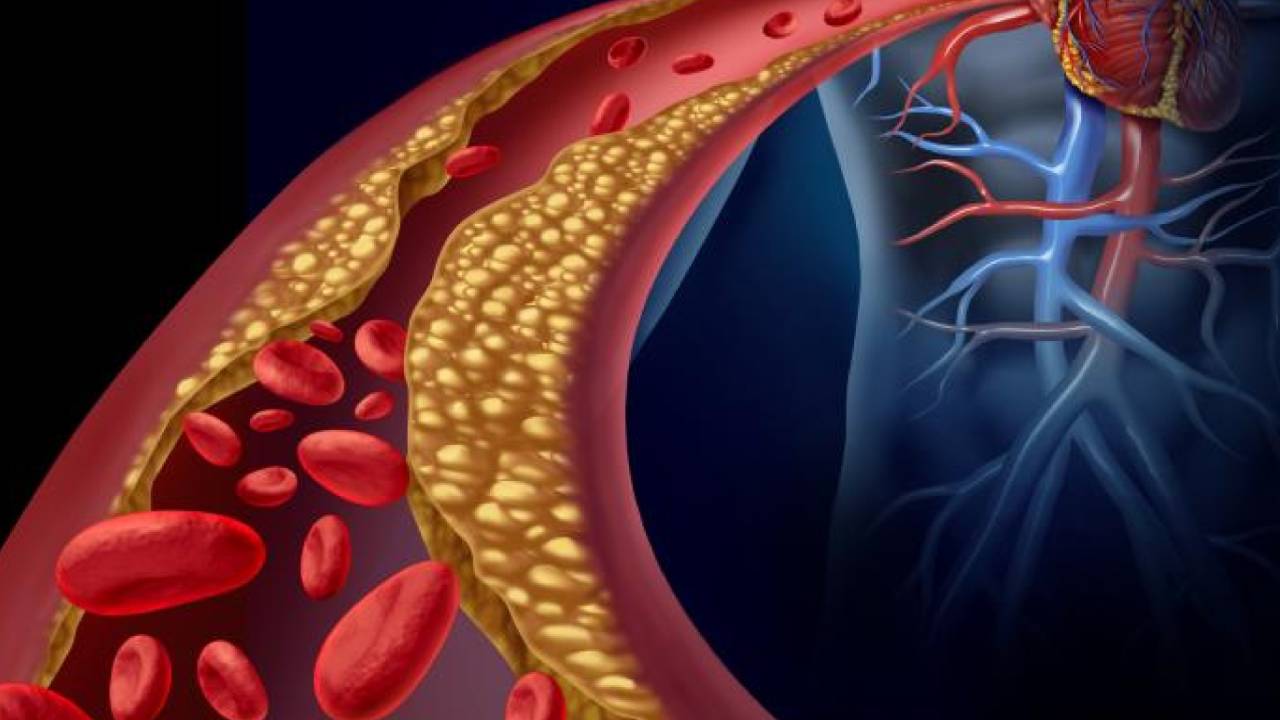 عادات غذائية لخفض الكوليسترول في الدم بعد سن الـ50