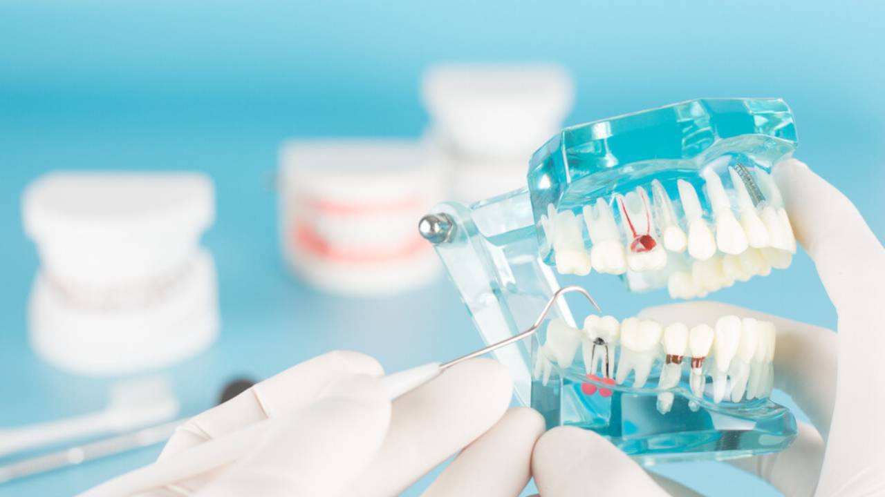 3  تحديات أمام طب الأسنان بالمملكة.. وطبيب يتحدث عن نسبة «صادمة» لتسوس الأسنان