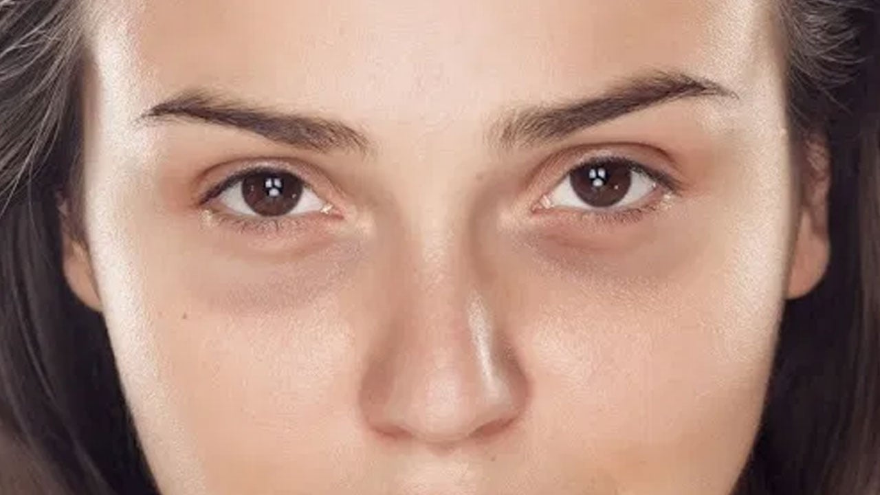 هكذا تتخلصين من مشكلات البشرة بعد الولادة