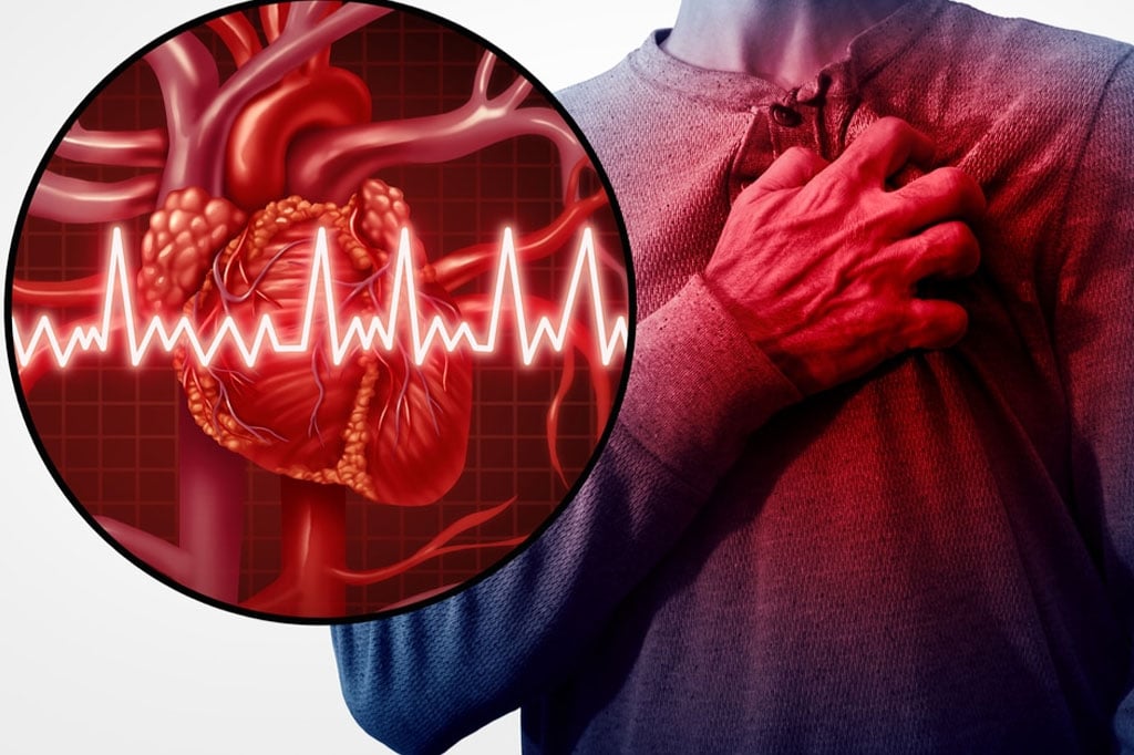 النمر يحدد 5 أمراض خطيرة مرتبطة بخفقان القلب