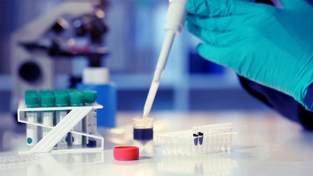 تراجع معدل الوفيات اليومي بـ«كورونا» في مستشفيات فرنسا إلى 198 حالة