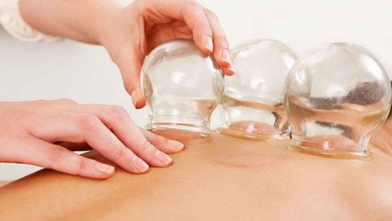 النمر يحذر من إجراء الحجامة أثناء استخدام أحد أدوية سيولة الدم