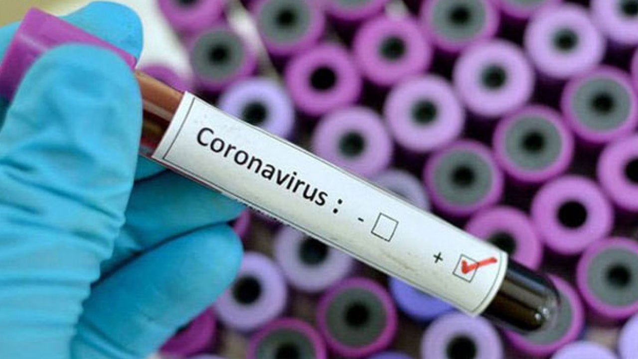 «فاوتشي» يتراجع عن موعد توفير لقاح كورونا للجميع في أمريكا