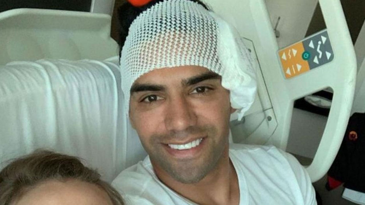 كسر في الوجه.. فالكاو يغادر المستشفى