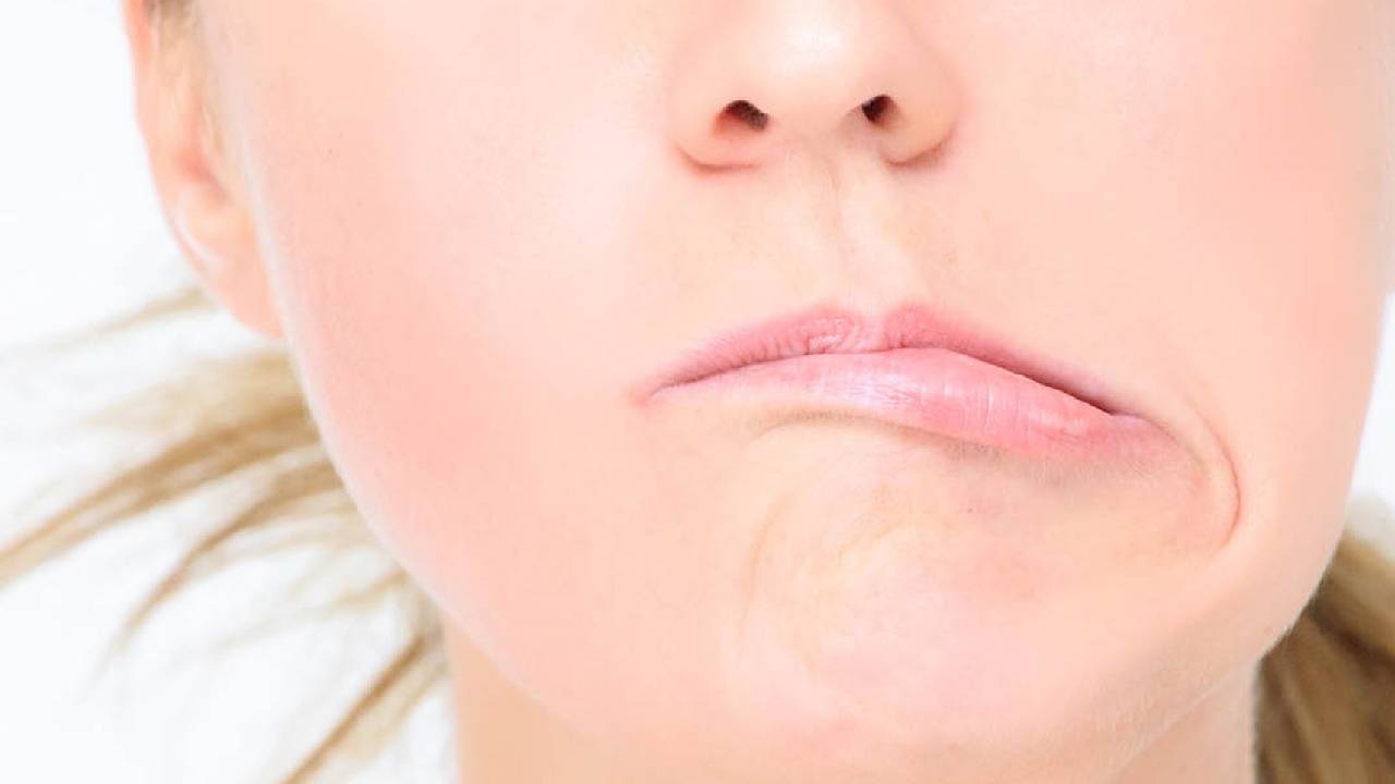 أعراض شلل العصب الوجهي.. ومختصون يحذرون من 3 أسباب