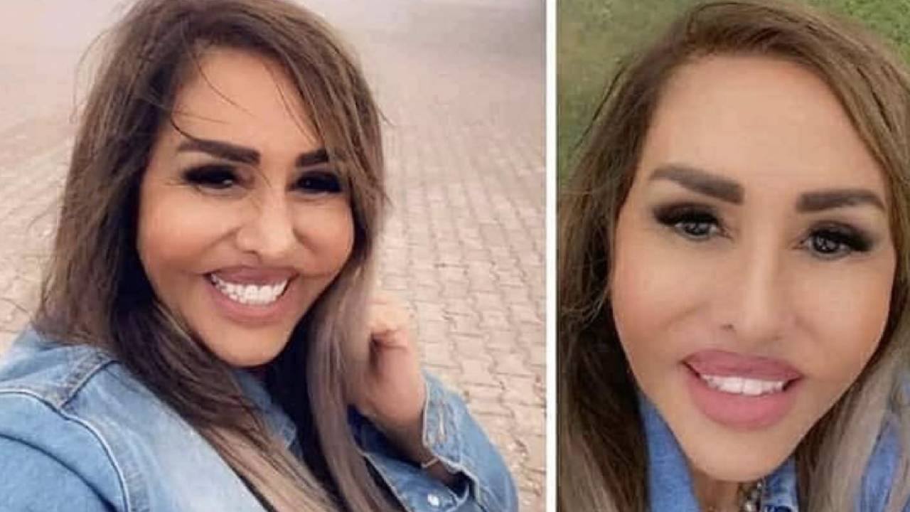 مها المصري تفاجئ جمهورها بملامح غير مألوفة بعد إجراء عملية تجميل
